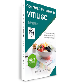 Controle Ud. mismo el Vitiligo