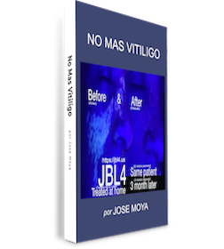 No Más Vitíligo