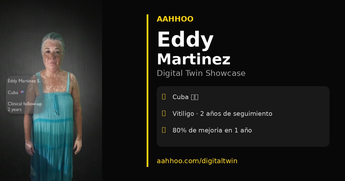 Eddy Martínez