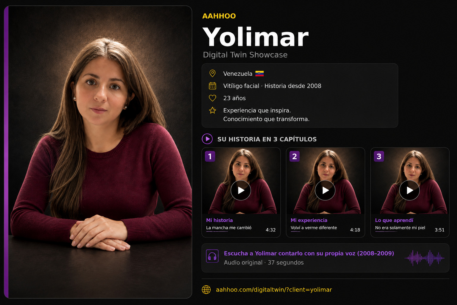 Yolimar
