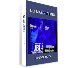 No Más Vitíligo